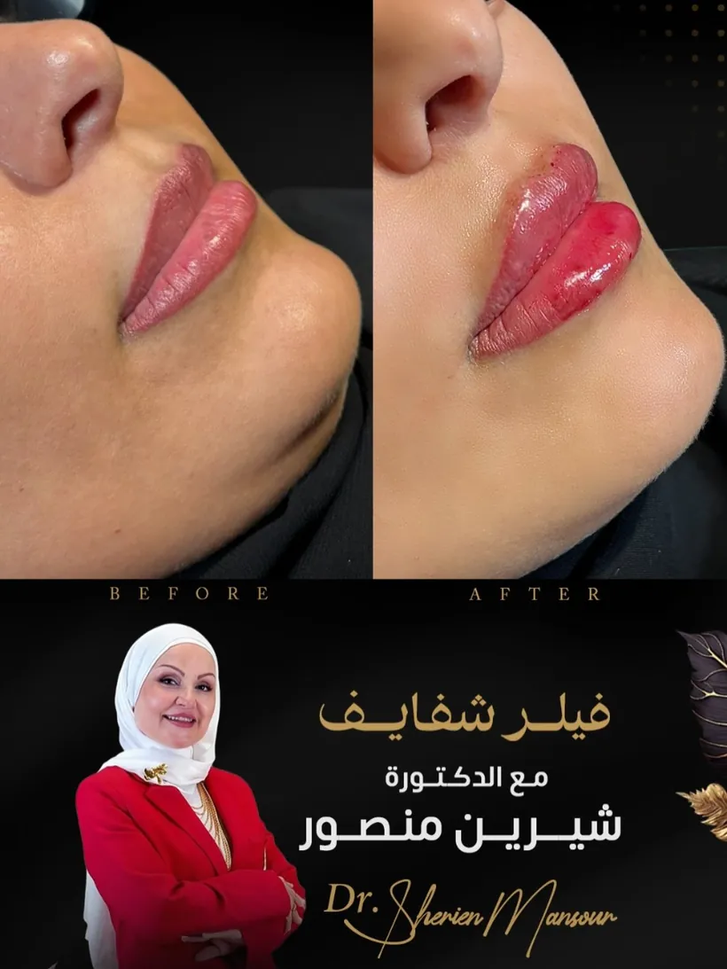 نتيجة